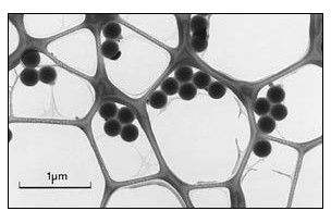 TEM Calibration Standard Grid